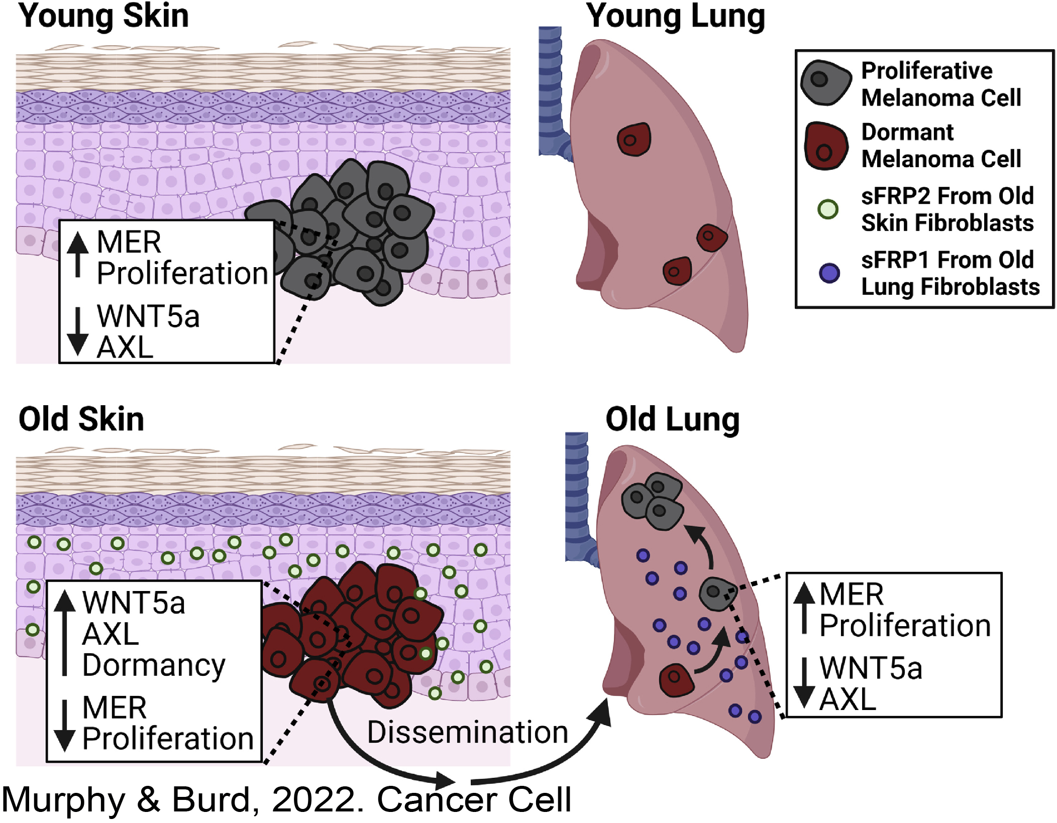 fane-lab-page-figure-1.jpg diagram of young skin with proliferative melanoma and old skin with dormant melanoma