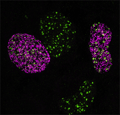 Visualizing DNA damage (green) and DNA replication (purple)