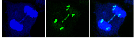 Markers of genome instability: aneuploidy and lagging chromosome visualized during mitosis using chromosome painting