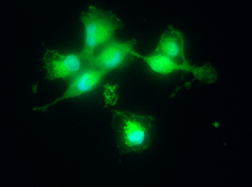 Breast cancer cells dying following eleostearic acid treatment. The green color shows the accumulation of toxic lipid peroxidation products in the cells.