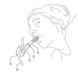 Figure: System administering gas to a patient comprising the nasal cannula adapter, a nasal cannula, and an airway device. 10 - nasal cannula adapter 16 - connector 50 - nasal cannula 60 - airway device 64 - standard fixture, connector or adapter that enables the airway device to be operably connected to a gas source