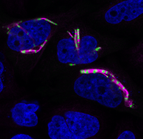 The labs discovered that the CCDC170 protein localized to the cell’s protein-sorting organelle, the Golgi apparatus. 