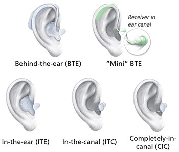 Credit: NIH Medical Arts