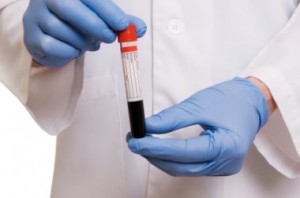 A close up photo of a medical professional's torso, holding a vial of blood in front of them with latex gloved hands.