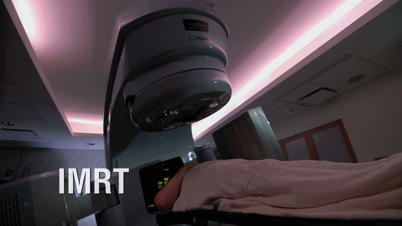Intensity-Modulated Radiation Therapy (IMRT)