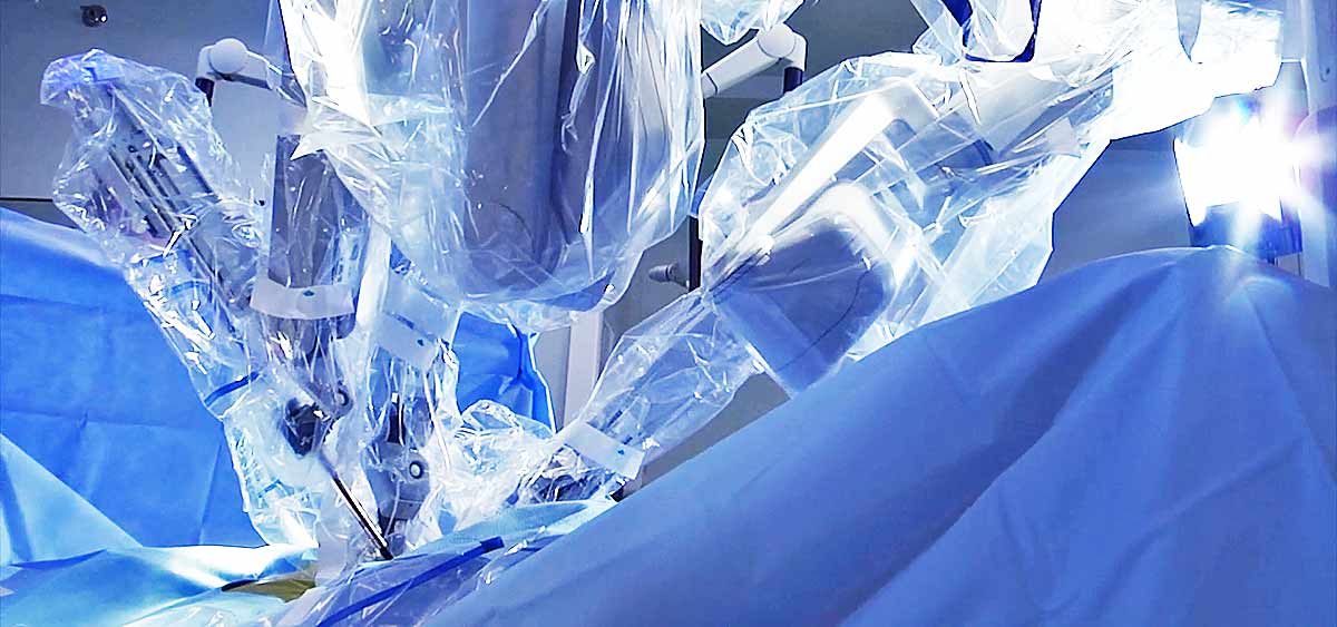 The retroperitoneal approach