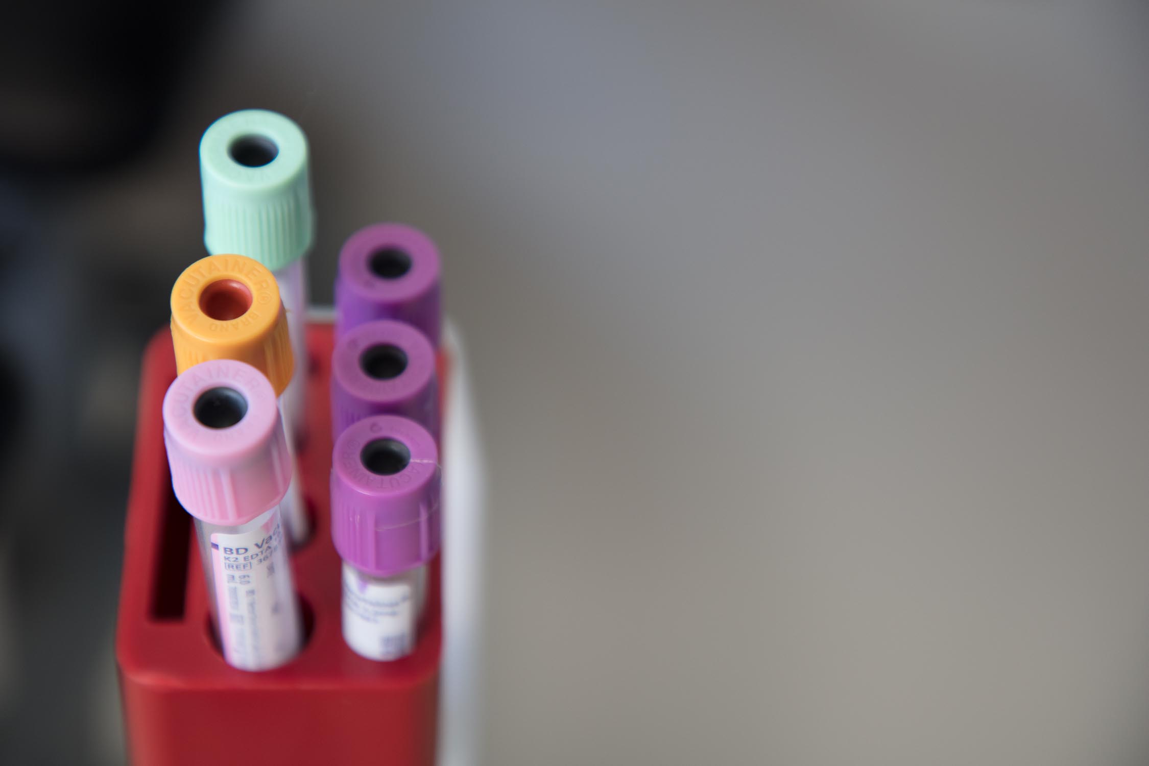 A blurred photograph of six labelled vials of various sizes and lid colors in a red holder.