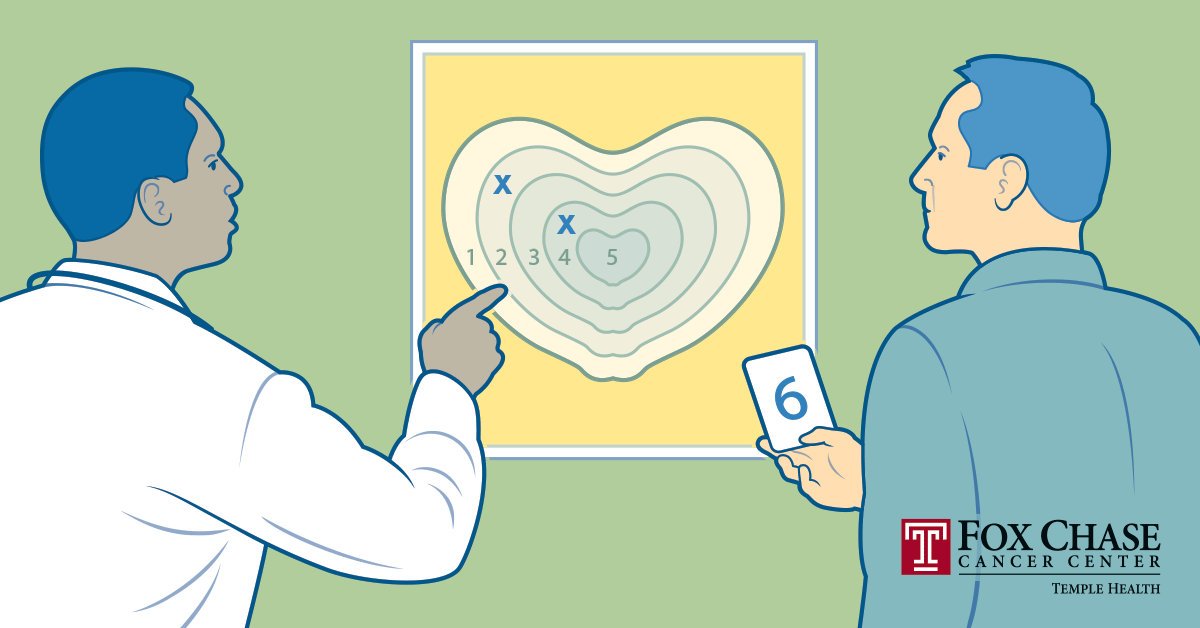 A drawing of a doctor showing a patient a chart on the wall depicting the Gleason Score groups.