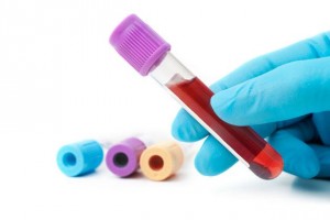 A close up photo of a blue gloved hand holding a vial filled with blood, with three other vials set down next to it.
