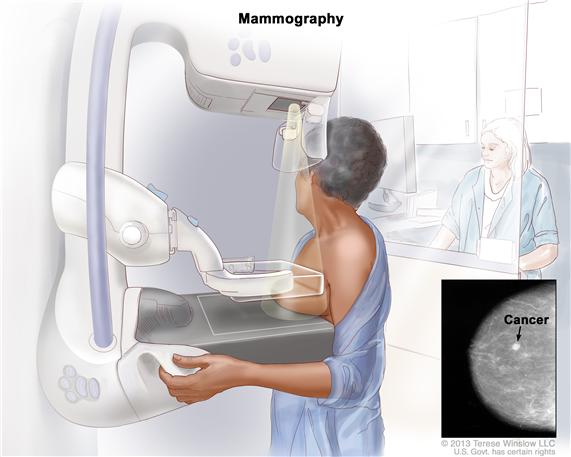 A drawing of a medical room, with one person standing behind a wall and the other receiving a mammogram.