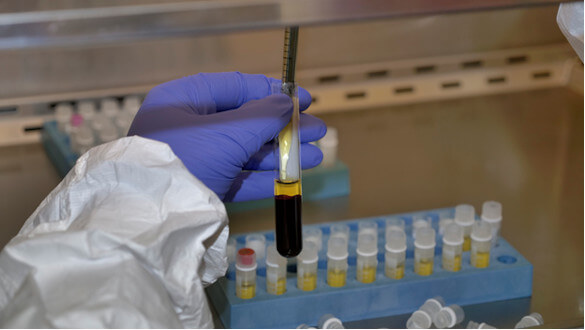 bio-repo-manual-fractionation.jpg