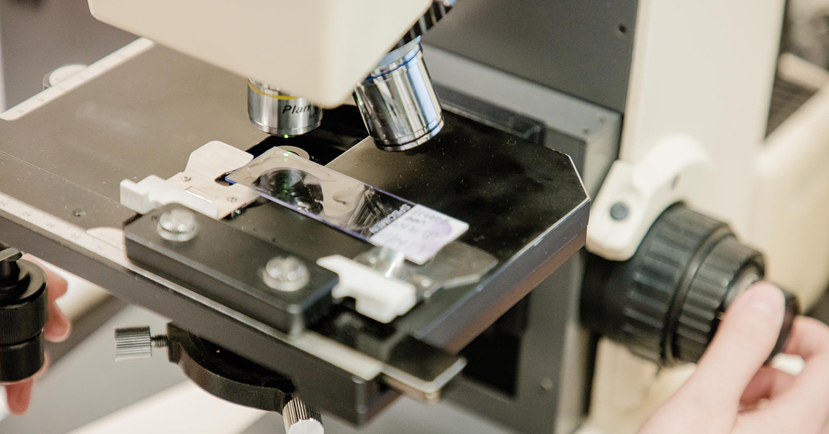 A closeup photo of a small glass slide under a microscope, a hand adjusting the focus knob to the side.