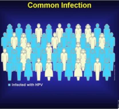 Link to /sites/default/files/styles/card/public/images/blog/thumb/HPV_Infection-300x225.jpg?h=73541a1f&itok=oJMYi5in