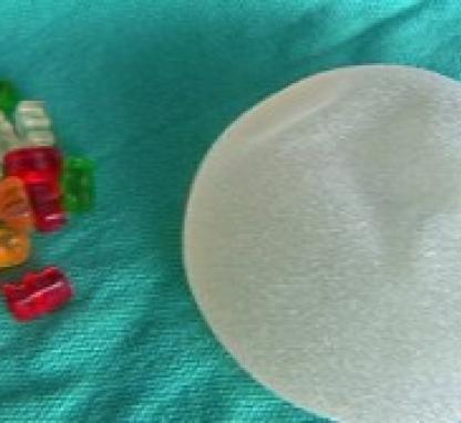 Link to /sites/default/files/styles/card/public/images/blog/thumb/gummy-bear-implant-300x168.jpg?h=284110ac&itok=vEbh_QjL