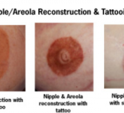 Link to /sites/default/files/styles/card/public/images/blog/thumb/tattooing.jpg?h=d3a4b210&itok=Smdig_1z