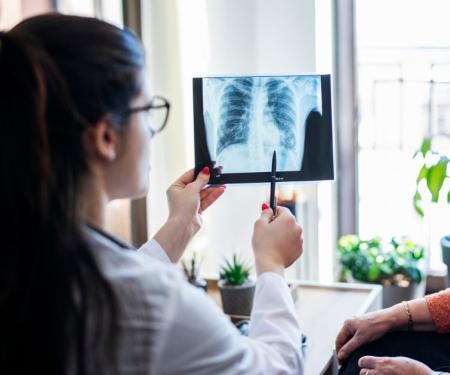 Lung Cancer Blog