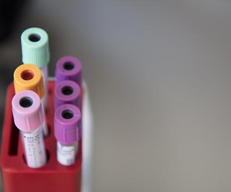 A blurred photograph of six labelled vials of various sizes and lid colors in a red holder.