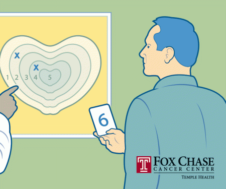 A drawing of a doctor showing a patient a chart on the wall depicting the Gleason Score groups.