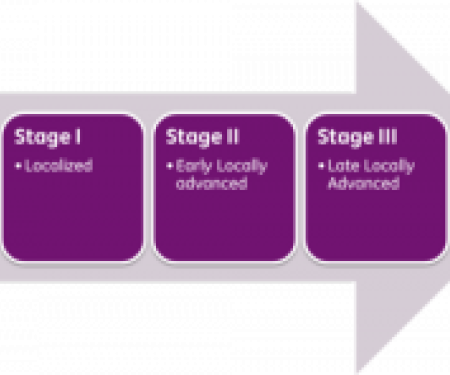 Link to /sites/default/files/styles/post_teaser_image_300x250_/public/images/blog/thumb/Cancer_stages-300x148.png?h=a7166f25&itok=iGcO7L7V