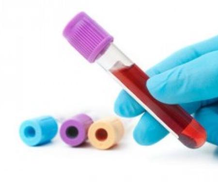 A close up photo of a blue gloved hand holding a vial filled with blood, with three other vials set down next to it.