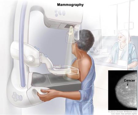 A drawing of a medical room, with one person standing behind a wall and the other receiving a mammogram.