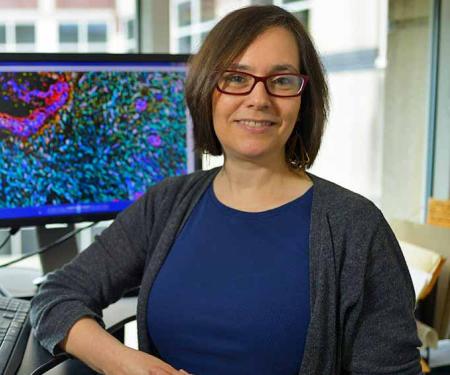 It is hoped the novel and collaborative approach among the researchers will lead to a better way to prevent or circumvent melanoma therapy resistance in aging cells.