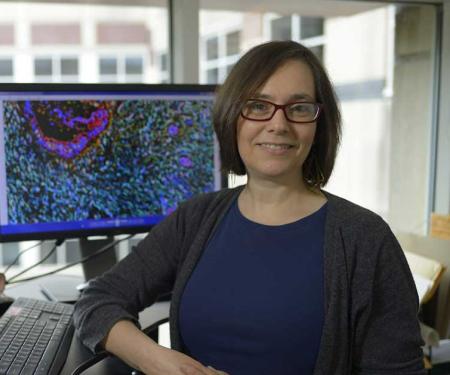 Edna (Eti) Cukierman, PhD Professor Co-Leader, Cancer Signaling and Epigenetics Program