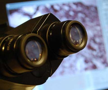 Starving Cancer Cells of Cholesterol Inhibits Tumor Growth and Improves Drug Sensitivity