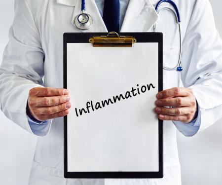 A physician wearing a lab coat, holding a clipboard that reads, "inflammation."