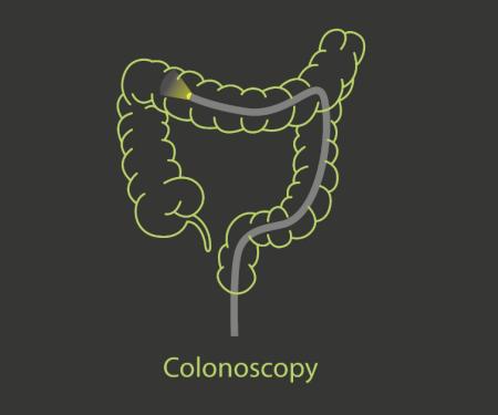 A linework drawing of a colon and a flashlight going all the way through it, with the word "Colonoscopy" written underneath.