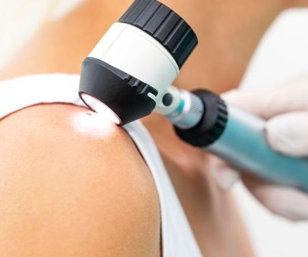 A close up photograph of a medical professional using a handheld tool to example a small lump on a patient's shoulder.