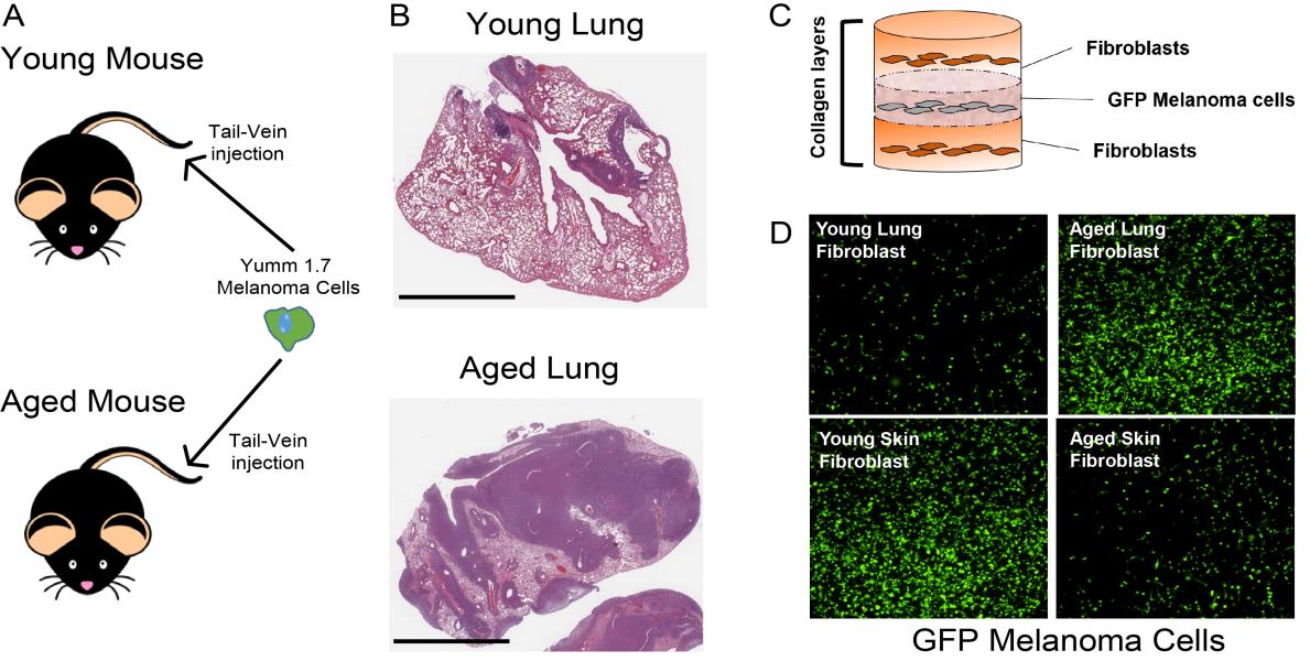 diagram of young mouse vs. old mouse, young lung vs. aged lung, collagen layers, and fibroblasts