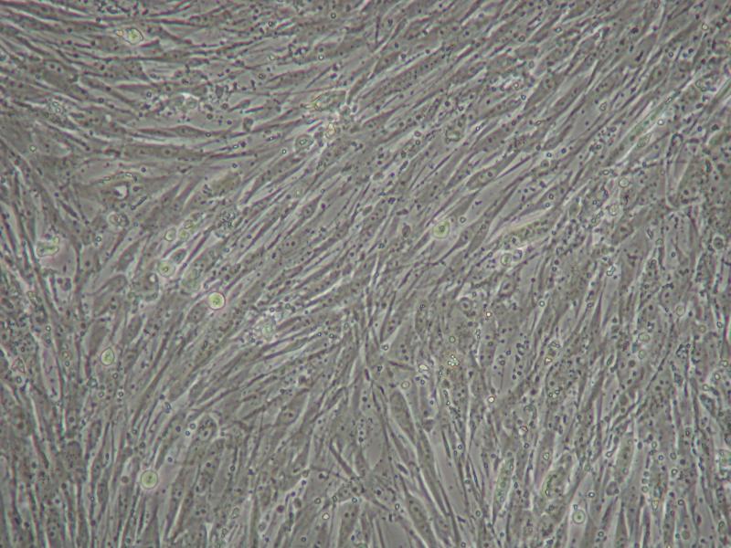 Human Tongue Fibroblast Cells (FC-HN2 IIA)