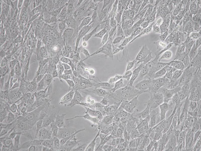 Mouse Melanoma Cells