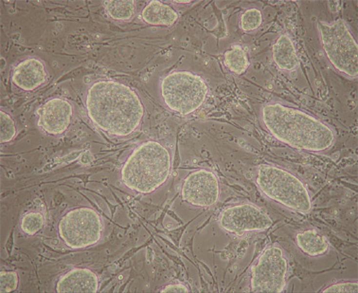 Embyronic Stem (ES) Cell Colonies on an Irradiated MEF (Feeder) Layer