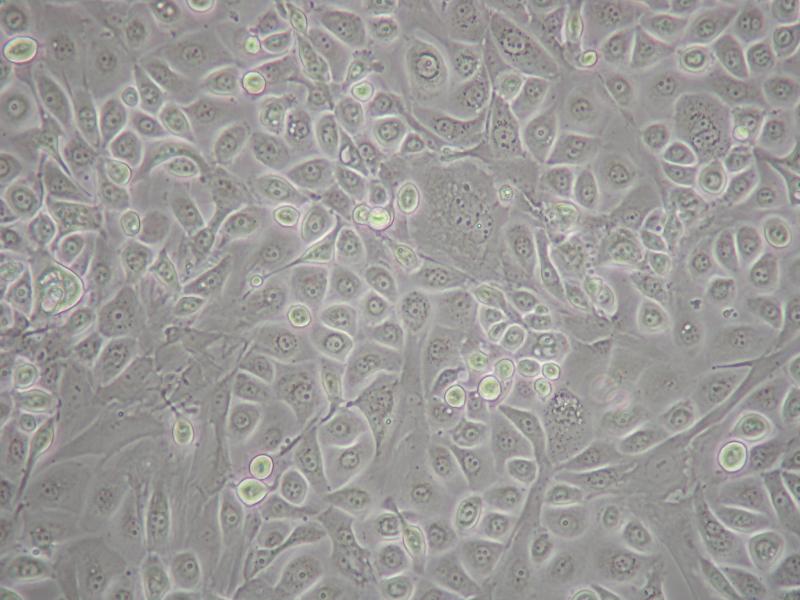 Human Tongue Epithelial Cells (FC-HN2 Low Cal)