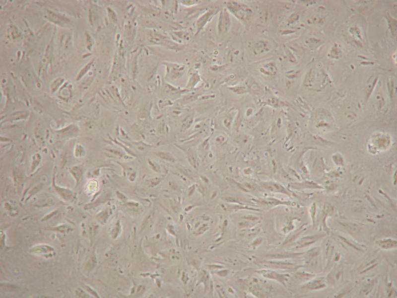 SID 511 Normal Human Colon Fibroblast Cells