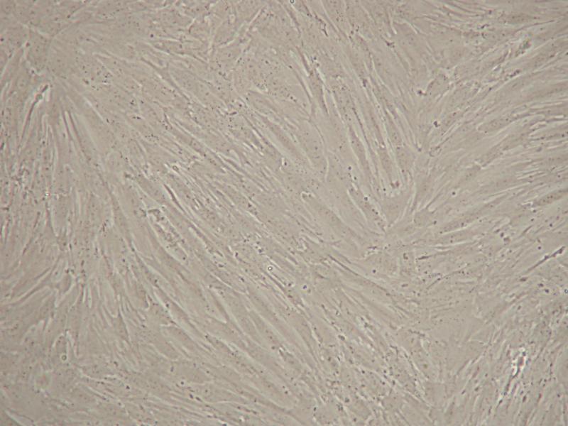 SID 622 FAP Human Colon Fibroblast Cells