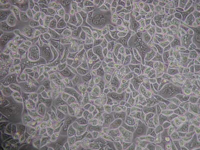 SID 333 FAP Human Colon Epithelial Cells