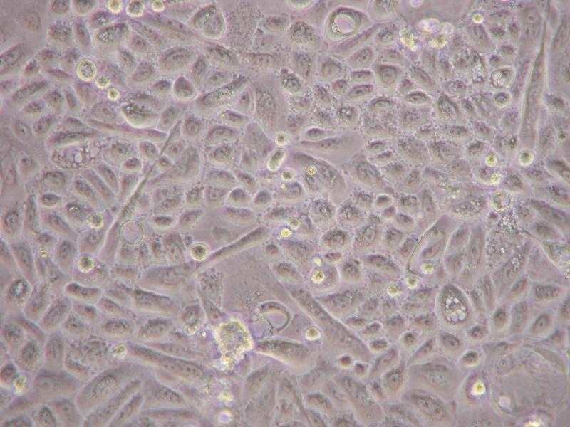 Mouse Lung Endothelial Cells