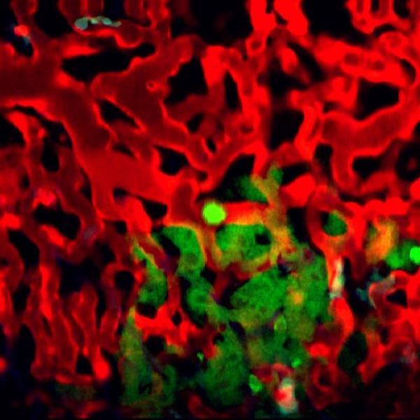 Dormant disseminated tumor cells in metastatic sites - slide 2