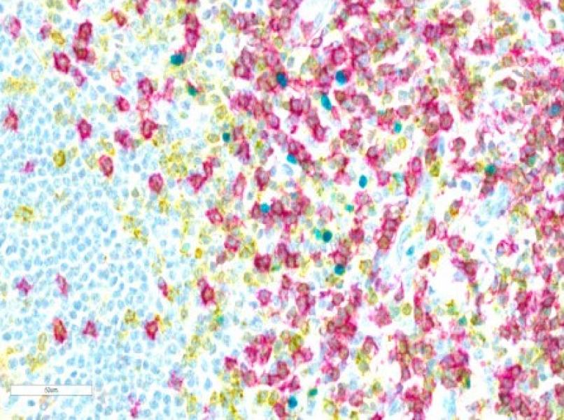 Link to /sites/default/files/styles/slider_desktop/public/2024-02/image2.jpg?itok=gOA7L9D0