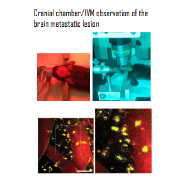 Cranial chamber/IVM observation of the brain metastatic lesion