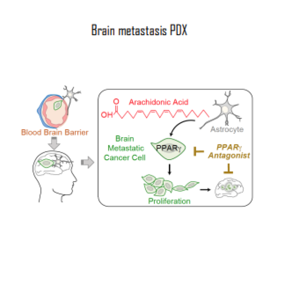 Brain metastasis PDX