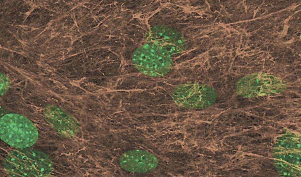 Normal fibroblast-derived 3D culture