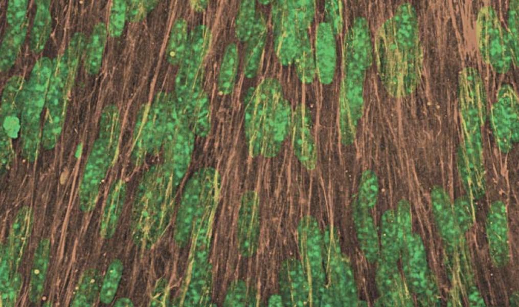 Tumor-associated fibroblast-derived 3D culture