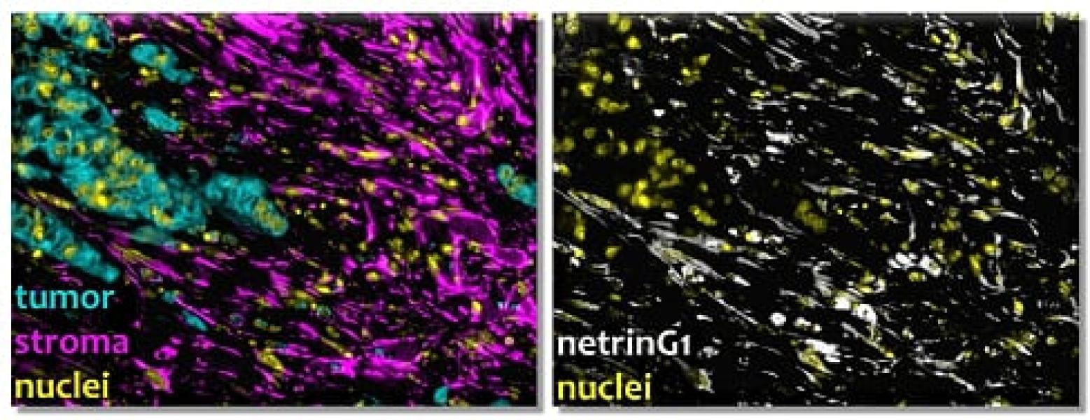 Link to /sites/default/files/styles/slider_desktop/public/images/slide/Cukie_Human%20Pancreatic%20Cancer%20-%20NetrinG1%20stroma%20expression.jpg?itok=XWmtc3lz