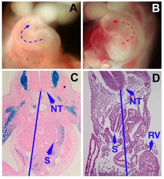 Lack of cilia in Ift122 knock-out embryos