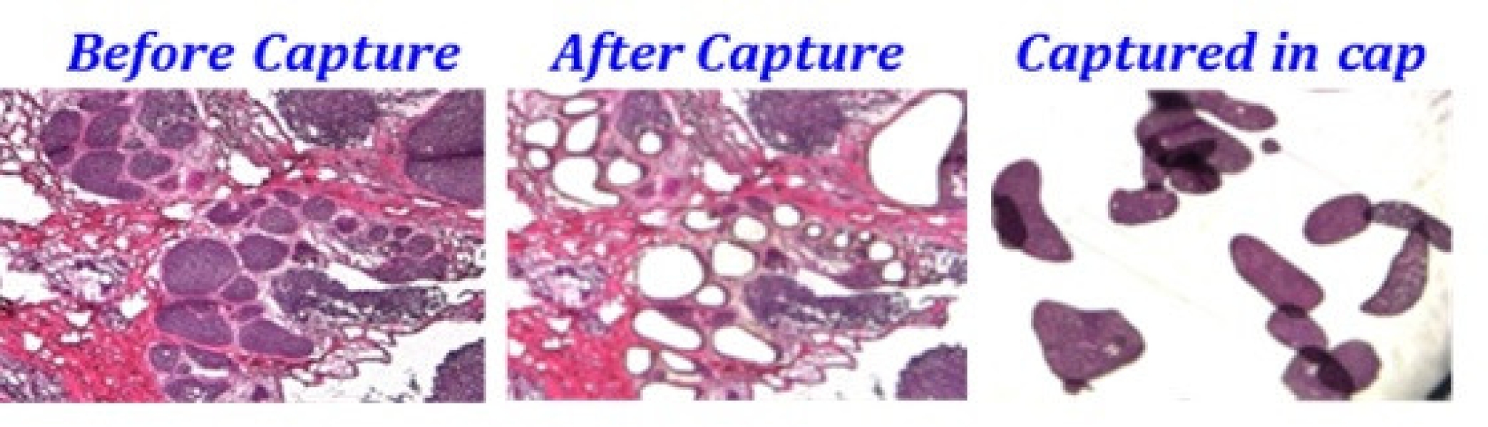 Link to /sites/default/files/styles/slider_desktop/public/images/slide/breast-microdissection.jpg?itok=SS6JLMSt