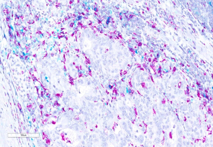 Link to /sites/default/files/styles/slider_desktop/public/images/slide/cd-68-purple-teal.jpg?itok=3V1kGc6M